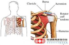 肩周炎的病因症状以及预防